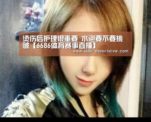 烫伤后护理很重要 水泡要不要挑破【6686体育赛事直播】(图3) 6686电竞竞猜